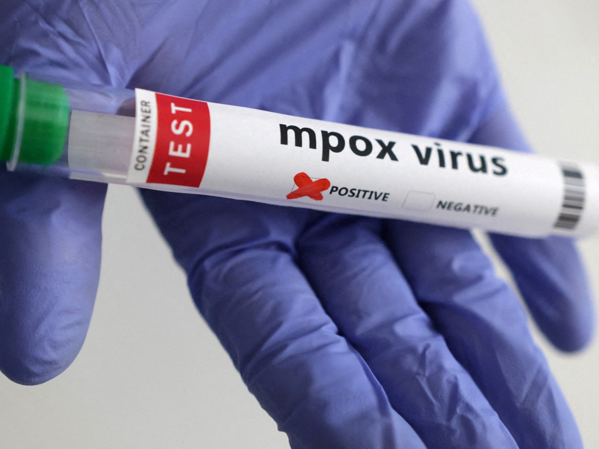 Mpox no longer international health emergency but remains concern in Africa | Health News